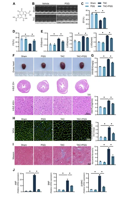  PQQ 可以抑制心肌肥厚和纤维化